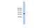 Transmembrane Channel Like 2 antibody, A10643, Boster Biological Technology, Western Blot image 