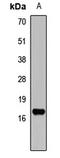 Natriuretic Peptide A antibody, orb412015, Biorbyt, Western Blot image 