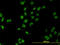 Mesenchyme Homeobox 2 antibody, LS-B5472, Lifespan Biosciences, Immunofluorescence image 