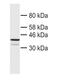 Charged Multivesicular Body Protein 4B antibody, 13683-1-AP, Proteintech Group, Western Blot image 