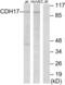 Cadherin 17 antibody, abx013917, Abbexa, Western Blot image 