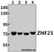 Zinc Finger Protein 23 antibody, A13364-1, Boster Biological Technology, Western Blot image 