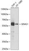 Semenogelin 1 antibody, GTX54712, GeneTex, Western Blot image 