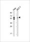 Serine/threonine-protein kinase PINK1, mitochondrial antibody, M00201, Boster Biological Technology, Western Blot image 