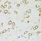 3-Phosphoinositide Dependent Protein Kinase 1 antibody, 16-696, ProSci, Immunohistochemistry paraffin image 