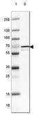 Choline Dehydrogenase antibody, NBP1-87508, Novus Biologicals, Western Blot image 