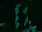 Potassium Two Pore Domain Channel Subfamily K Member 18 antibody, 23712-1-AP, Proteintech Group, Immunofluorescence image 