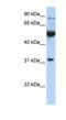 Eukaryotic Translation Initiation Factor 2B Subunit Alpha antibody, NBP1-57644, Novus Biologicals, Western Blot image 