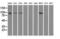 Hexokinase 2 antibody, LS-C114928, Lifespan Biosciences, Western Blot image 