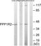 Protein phosphatase inhibitor 2 antibody, TA314368, Origene, Western Blot image 