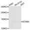 Sodium Voltage-Gated Channel Alpha Subunit 8 antibody, abx135926, Abbexa, Western Blot image 