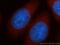 Non-SMC Condensin I Complex Subunit D2 antibody, 13382-1-AP, Proteintech Group, Immunofluorescence image 