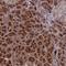 Adaptor Related Protein Complex 4 Subunit Epsilon 1 antibody, HPA041749, Atlas Antibodies, Immunohistochemistry paraffin image 