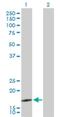 SEC61 Translocon Beta Subunit antibody, H00010952-D01P, Novus Biologicals, Western Blot image 