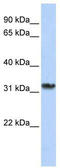Survival Motor Neuron Domain Containing 1 antibody, TA345933, Origene, Western Blot image 