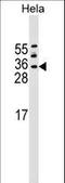 Histone chaperone ASF1A antibody, LS-C159133, Lifespan Biosciences, Western Blot image 