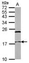 Nuclear Cap Binding Protein Subunit 2 antibody, NBP2-15732, Novus Biologicals, Western Blot image 