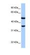 DnaJ Heat Shock Protein Family (Hsp40) Member B6 antibody, NBP1-54951, Novus Biologicals, Western Blot image 