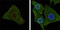 B-Raf Proto-Oncogene, Serine/Threonine Kinase antibody, abx015780, Abbexa, Enzyme Linked Immunosorbent Assay image 