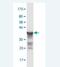 Ring Finger Protein 20 antibody, H00056254-M02, Novus Biologicals, Western Blot image 