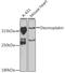 Desmoplakin antibody, GTX32557, GeneTex, Western Blot image 