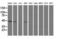 Phosphatidylinositol-5-Phosphate 4-Kinase Type 2 Alpha antibody, LS-C172607, Lifespan Biosciences, Western Blot image 