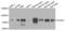 Acyl-CoA Synthetase Long Chain Family Member 6 antibody, LS-C409508, Lifespan Biosciences, Western Blot image 