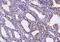 Annexin A4 antibody, A04840-2, Boster Biological Technology, Immunohistochemistry paraffin image 