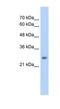 NMDA Receptor Synaptonuclear Signaling And Neuronal Migration Factor antibody, NBP1-54835, Novus Biologicals, Western Blot image 