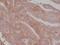 CD276 Molecule antibody, NBP2-77415, Novus Biologicals, Immunohistochemistry paraffin image 