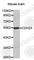 Cadherin Related 23 antibody, A2785, ABclonal Technology, Western Blot image 