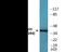 Casein Kinase 1 Alpha 1 antibody, EKC2560, Boster Biological Technology, Western Blot image 