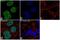 Polycomb protein SUZ12 antibody, 702490, Invitrogen Antibodies, Immunocytochemistry image 