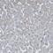 Polypeptide N-Acetylgalactosaminyltransferase 6 antibody, HPA017086, Atlas Antibodies, Immunohistochemistry paraffin image 