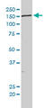 Non-SMC Condensin II Complex Subunit D3 antibody, LS-C105120, Lifespan Biosciences, Western Blot image 