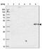 O-Sialoglycoprotein Endopeptidase antibody, NBP1-83378, Novus Biologicals, Western Blot image 