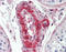 LIM Domain Containing Preferred Translocation Partner In Lipoma antibody, 49-067, ProSci, Immunohistochemistry paraffin image 