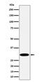 Thiopurine S-Methyltransferase antibody, M00671-2, Boster Biological Technology, Western Blot image 