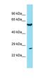 Twist Family BHLH Transcription Factor 1 antibody, orb329722, Biorbyt, Western Blot image 
