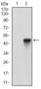 Activated Leukocyte Cell Adhesion Molecule antibody, GTX60782, GeneTex, Western Blot image 