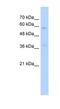 Integrin Subunit Beta Like 1 antibody, NBP1-59169, Novus Biologicals, Western Blot image 