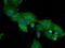 Dipeptidyl Peptidase 4 antibody, GTX84602, GeneTex, Immunocytochemistry image 