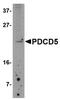 Serine/Threonine Kinase 39 antibody, PA5-20684, Invitrogen Antibodies, Western Blot image 