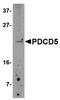 STE20/SPS1-related proline-alanine-rich protein kinase antibody, PA5-20684, Invitrogen Antibodies, Western Blot image 