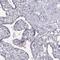 Kinesin Family Member 19 antibody, NBP2-57895, Novus Biologicals, Immunohistochemistry paraffin image 