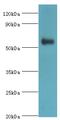 Poly(ADP-Ribose) Polymerase Family Member 3 antibody, MBS1499093, MyBioSource, Western Blot image 