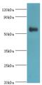 ADPRT3 antibody, MBS1499093, MyBioSource, Western Blot image 