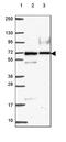 ADPRT3 antibody, HPA067657, Atlas Antibodies, Western Blot image 