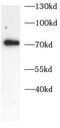Golgi Membrane Protein 1 antibody, FNab10755, FineTest, Western Blot image 