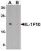 Interleukin 1 Family Member 10 antibody, PA5-38051, Invitrogen Antibodies, Western Blot image 